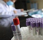 Explained | What are monoclonal antibodies?